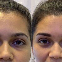 z5499915623579 7fff26f6065ae679fa2badd23efd1e80